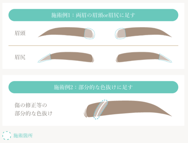 眉の追加部分施術、該当範囲