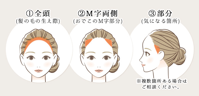 hairlineアートメイク、3つのメニュー