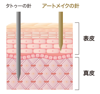 メディカルアートメイクとは