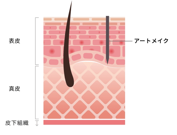 医療アートメイクとは